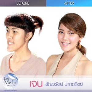 07 _ Thanwarat “Jane” Maksathit