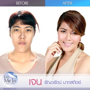 08 _ Thanwarat “Jane” Maksathit