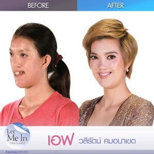 10 _ Waleerat “Eff” Komanaket