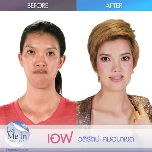 11 _ Waleerat “Eff” Komanaket