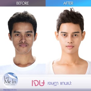 19 _ Jessada “Jess” Kaenpae