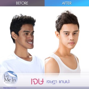 20 _ Jessada “Jess” Kaenpae