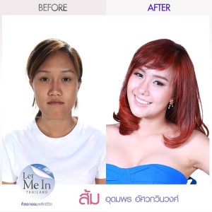 25 _ Udomporn “Som” Assawakawinwong