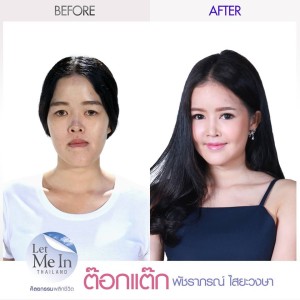 28 _ Patcharaporn “Toktak” Saiyawongsa