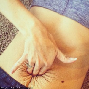 Stephanie Rothstein Viral Photo_1