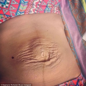 Stephanie Rothstein Viral Photo_8