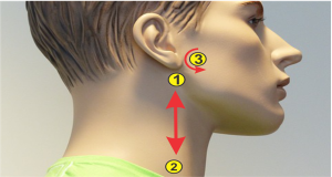 high blood pressure_1