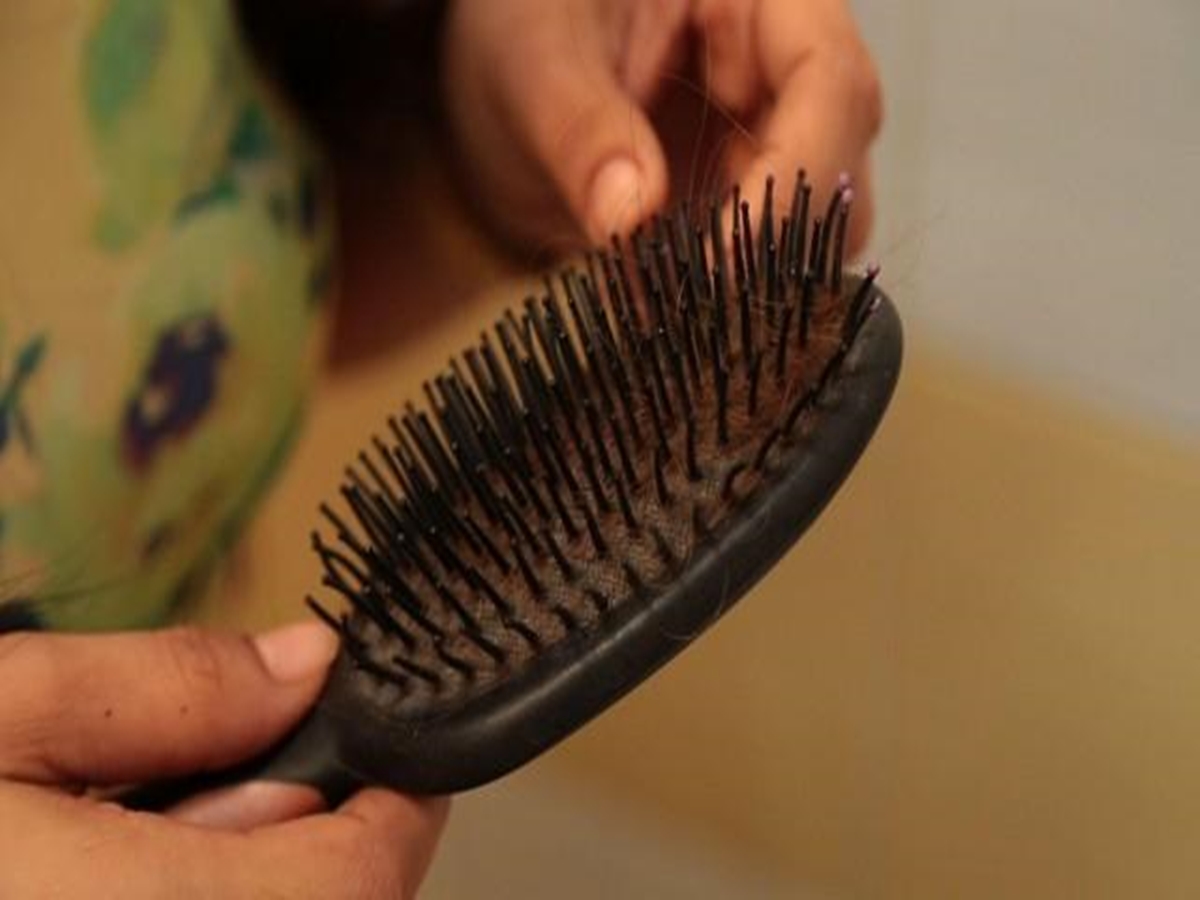 Hair Loss Natural Remedies