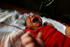 Eight-day old baby Allan, who was born with microcephaly, cries at home in Choluteca