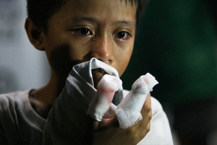 Firecracker Casualties