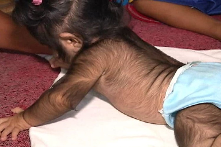 hairy baby