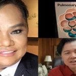 Chokoleit's Disease Pulmonary Edema, Heart Attack