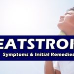 Heatstroke Treatment