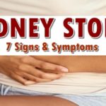 Kidney Stone