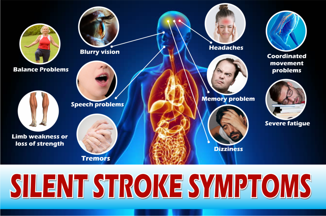 silent-stroke-symptoms-10-unnoticeable-signs-of-silent-mini-stroke