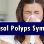 Nasal Polyps Symptoms