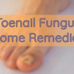 toenail fungus home remedies