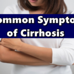 Cirrhosis Symptoms