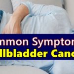 Gallbladder Cancer Symptoms