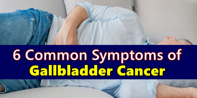 GALLBLADDER CANCER SYMPTOMS - 6 Warning Signs Often Ignored