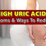 High Uric Acid