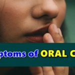 Oral Cancer Symptoms