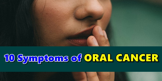 ORAL CANCER SYMPTOMS - 10 Signs Pointing To Possible Oral Cancer