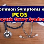 PCOS Syndrome