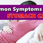 Stomach Cancer Symptoms