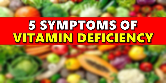 Vitamin Deficiency - 5 Signs Showing You're Deficient In Certain Vitamin