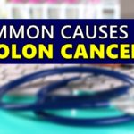Colon Cancer Symptoms
