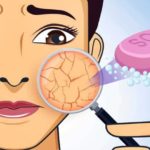 dry skin soaps