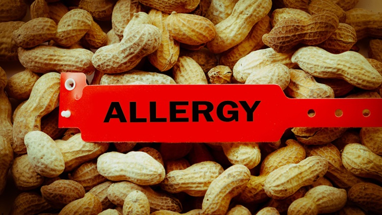 peanut allergy