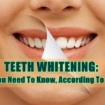 teeth whitening
