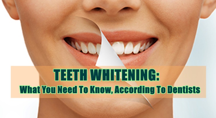 TEETH WHITENING: What You Need To Know, According To Dentists