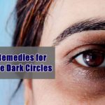 under eye dark circles