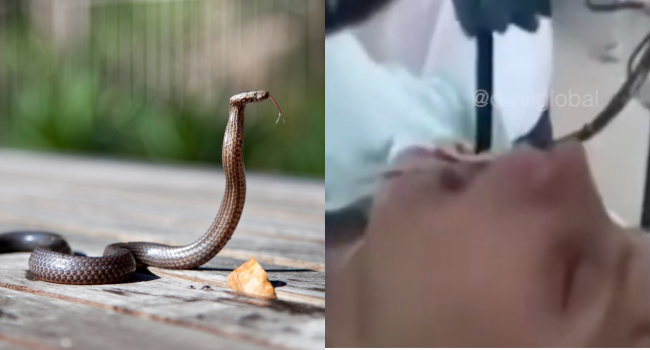 Doctors Pull 4-Foot Snake From Woman's Throat Goes Viral (VIDEO)